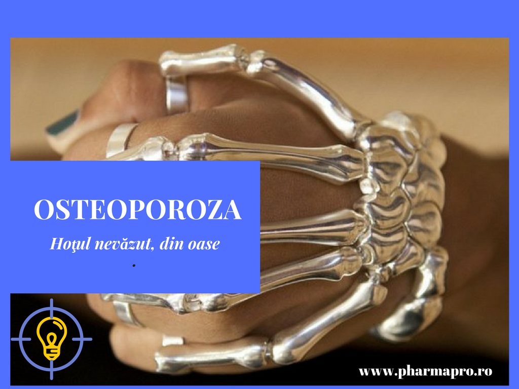 Osteoporoza - Ce este? Cauzele aparitiei, Simptome si Tratament | CENTROKINETIC